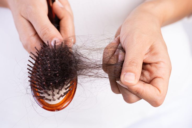 5 Tips Mengatasi Rambut Rontok agar Tetap Kuat