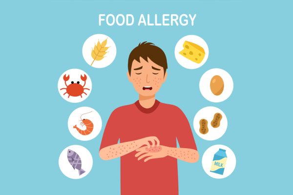 7 Tips Mengatasi Alergi Makanan dengan Aman 7 Tips Mengatasi Alergi Makanan dengan Aman