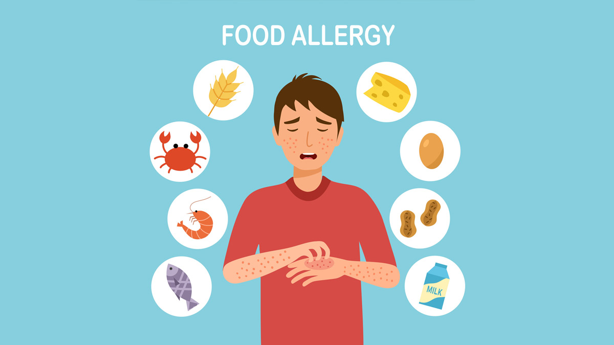 7 Tips Mengatasi Alergi Makanan dengan Aman
