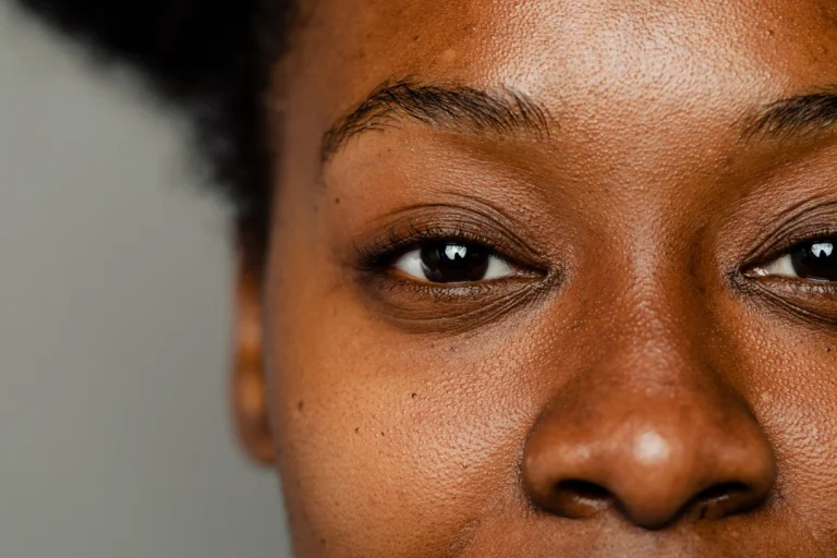 7 Tips Merawat Mata Kering agar Tetap Nyaman