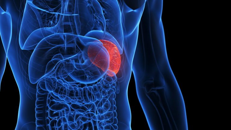 10 Langkah Sederhana Merawat Limpa Setiap Hari