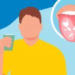 10 Cara Alami Mengatasi Lidah Berwarna Putih