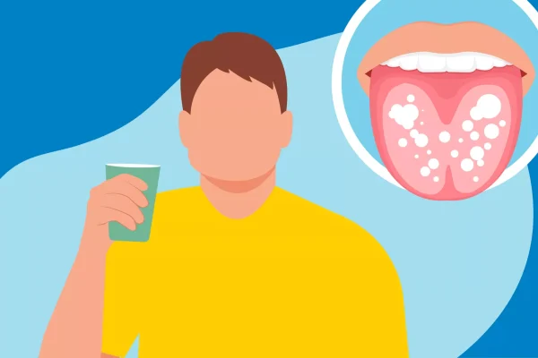 10 Cara Alami Mengatasi Lidah Berwarna Putih