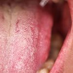 10 Kebiasaan Buruk yang Bisa Merusak Kesehatan Lidah
