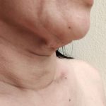5 Kebiasaan Sehari-hari yang Bikin Dagu Jadi Kendur