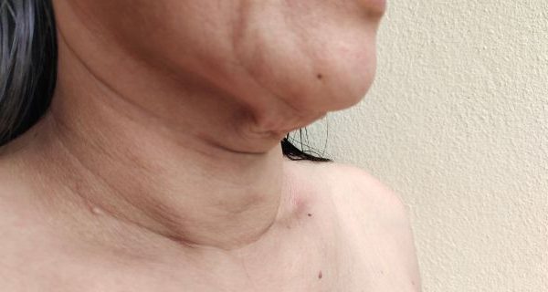 5 Kebiasaan Sehari-hari yang Bikin Dagu Jadi Kendur