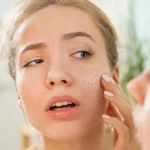 10 Cara Mengatasi Kulit Kering dengan Efektif