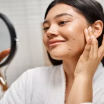 5 Langkah Membersihkan Wajah Agar Bebas Jerawat