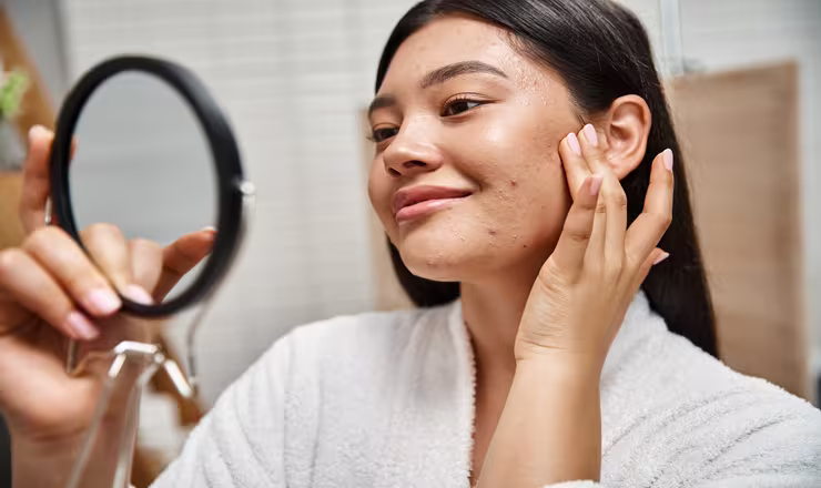 5 Langkah Membersihkan Wajah Agar Bebas Jerawat
